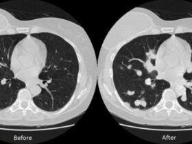 Hacker Rubano ricerca sul Cancro